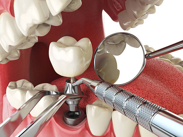 Reliable VA Emergency Dental Service Solutions